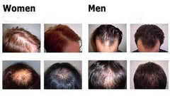 Jeeper's Keepers Organic Hair Growth Essence - Nourishing Ginseng for All Hair Types